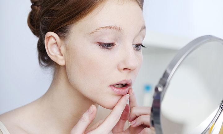 Contro l’herpes, un dolce aiuto.